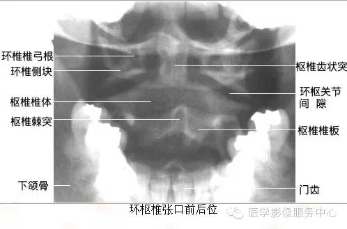 临床必备！脊柱的X线解剖