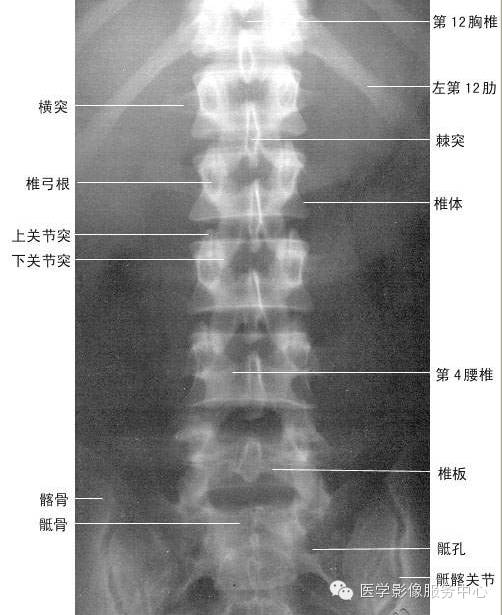 临床必备！脊柱的X线解剖