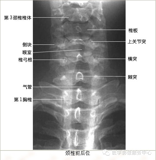 临床必备！脊柱的X线解剖