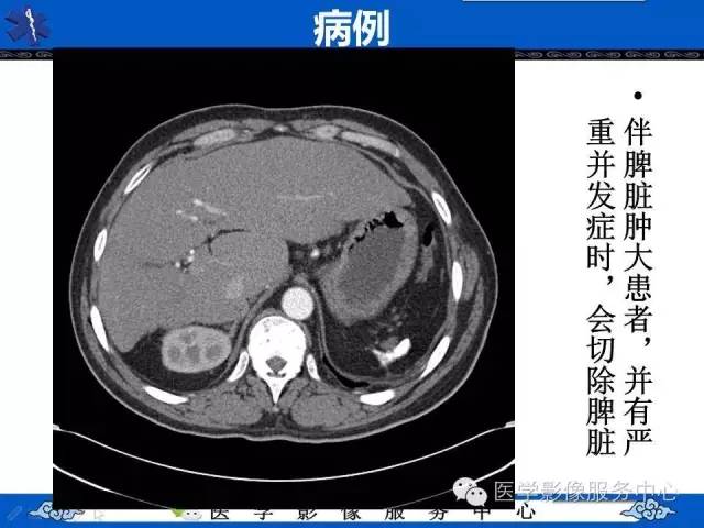 鱼口征的影像学表现，你了解吗？