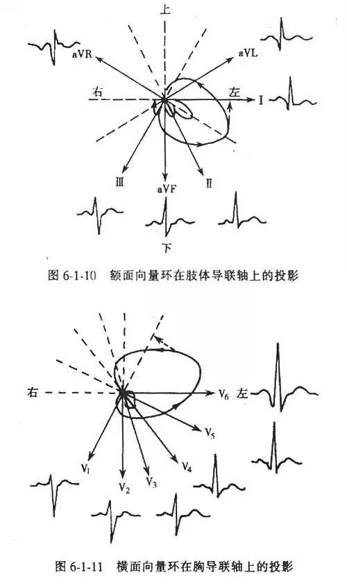 各型冠心病的心电图诊断与鉴别诊断