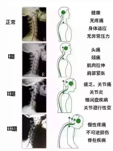 颈椎肌动学基础与评估，详细讲解！