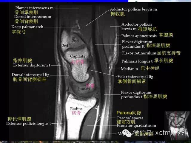 值得收藏！腕关节MR解剖中英对照