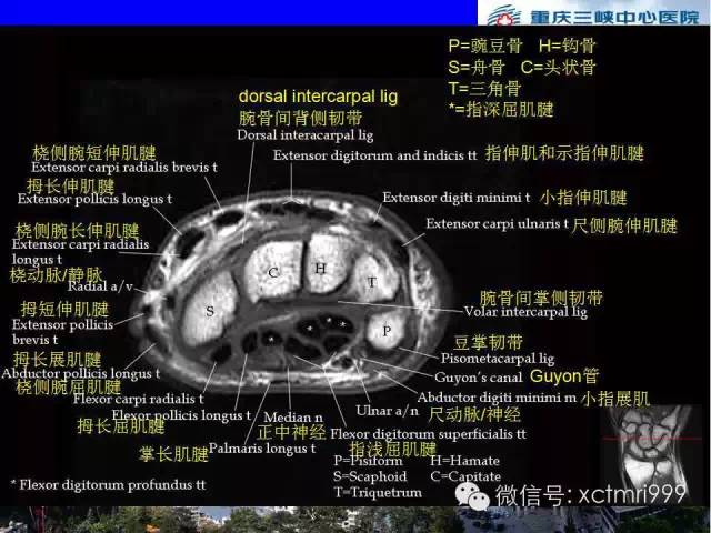 值得收藏！腕关节MR解剖中英对照