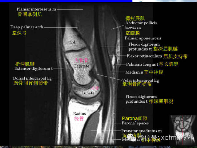 值得收藏！腕关节MR解剖中英对照