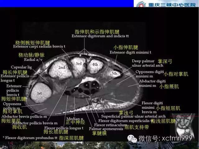 值得收藏！腕关节MR解剖中英对照