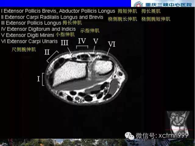 值得收藏！腕关节MR解剖中英对照