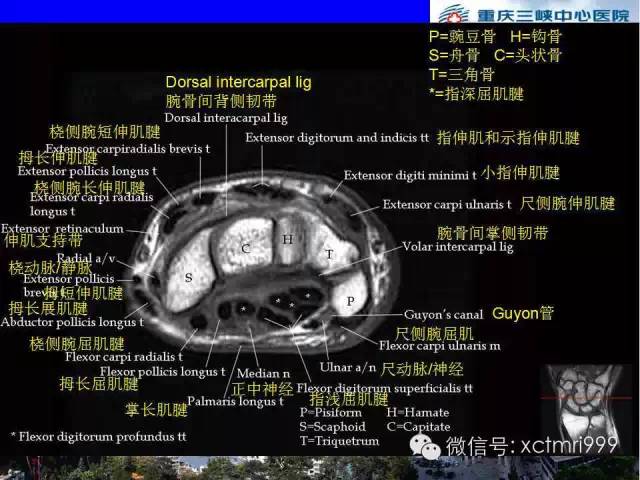 值得收藏！腕关节MR解剖中英对照