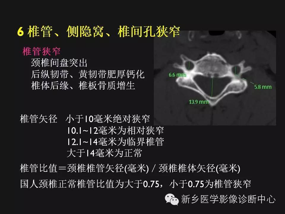 纯干货：颈椎病影像诊断重点汇总！