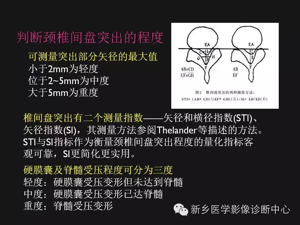 纯干货：颈椎病影像诊断重点汇总！