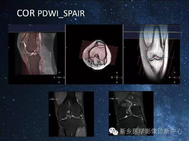 这些关节，磁共振如何扫描更好？