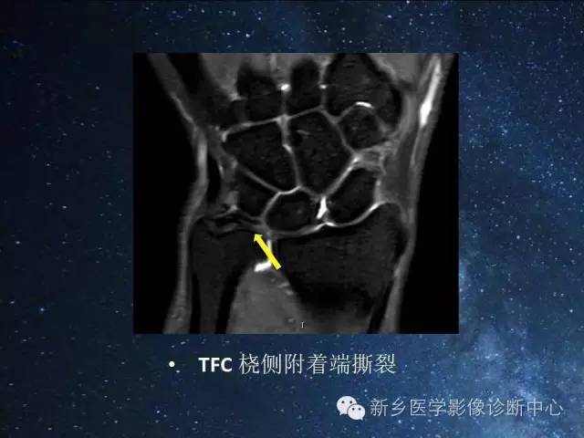 这些关节，磁共振如何扫描更好？