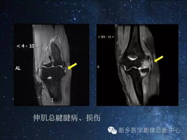 这些关节，磁共振如何扫描更好？