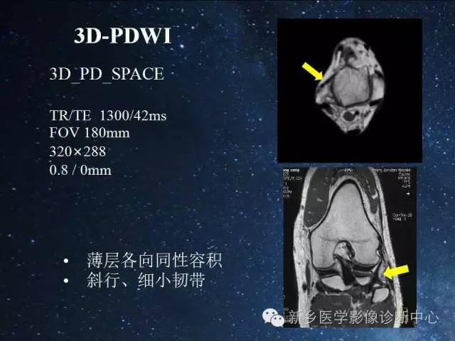 这些关节，磁共振如何扫描更好？