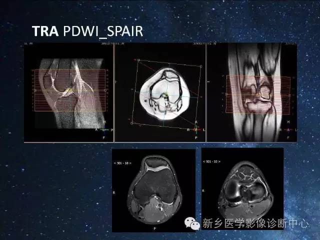 这些关节，磁共振如何扫描更好？