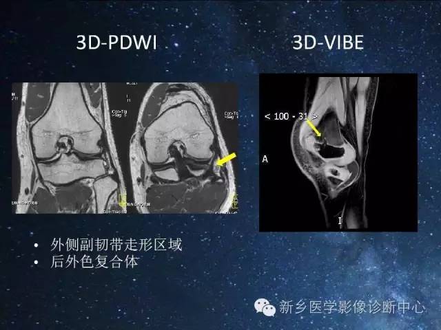 这些关节，磁共振如何扫描更好？