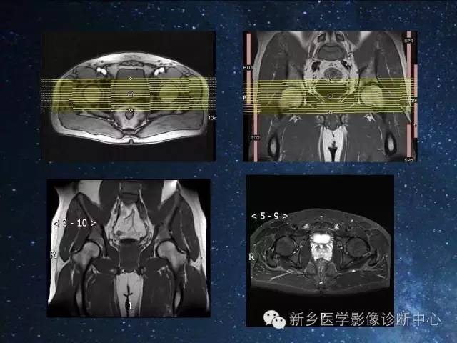 这些关节，磁共振如何扫描更好？