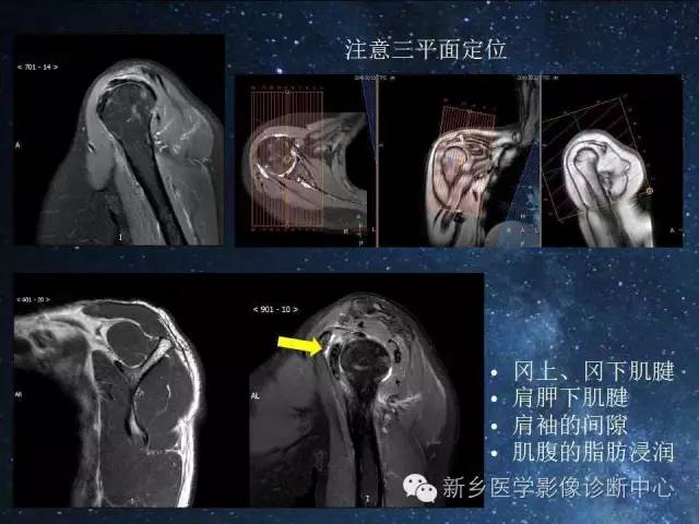 这些关节，磁共振如何扫描更好？