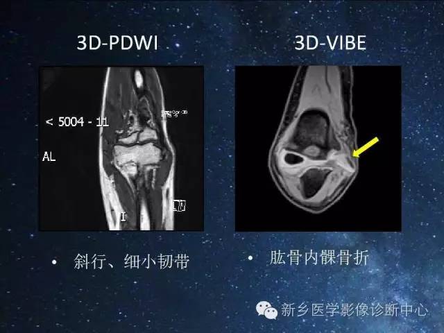 这些关节，磁共振如何扫描更好？