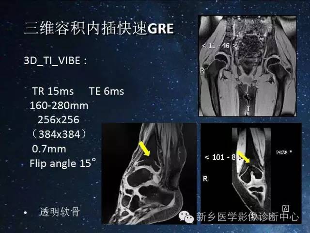 这些关节，磁共振如何扫描更好？