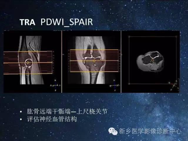 这些关节，磁共振如何扫描更好？