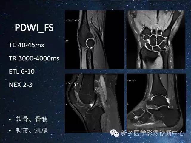 这些关节，磁共振如何扫描更好？