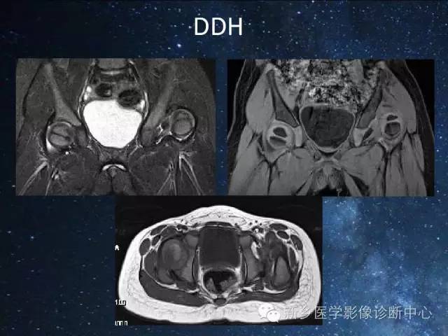 这些关节，磁共振如何扫描更好？