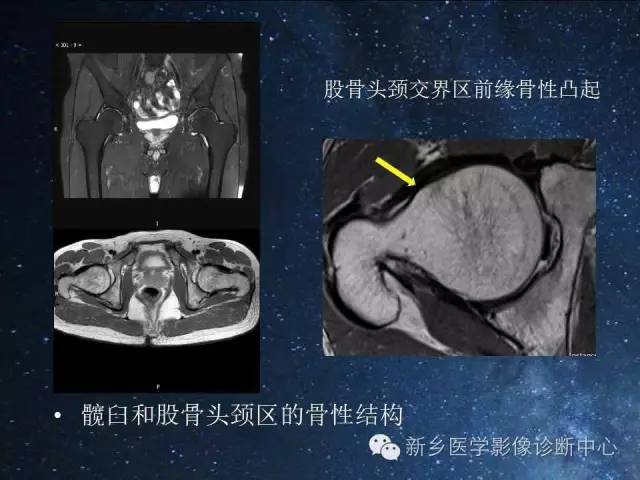 这些关节，磁共振如何扫描更好？