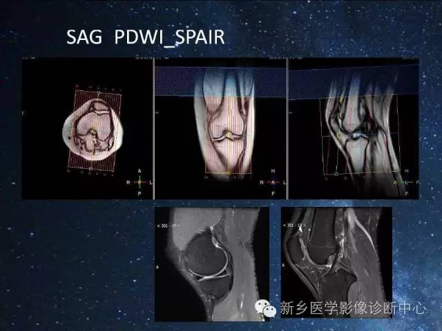 这些关节，磁共振如何扫描更好？