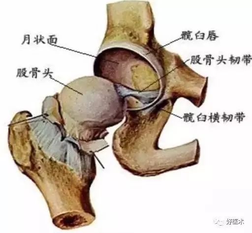 股骨头坏死的十大要点，帮你整理好了！