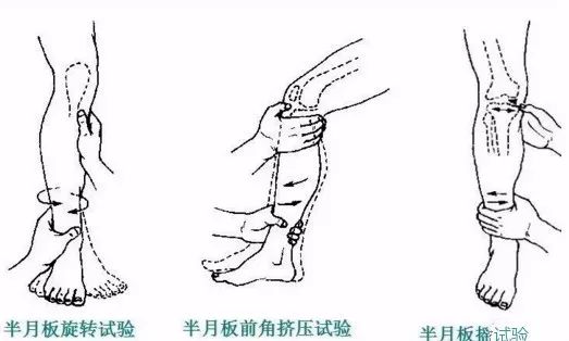 90%的运动损伤检查法，都在这里！