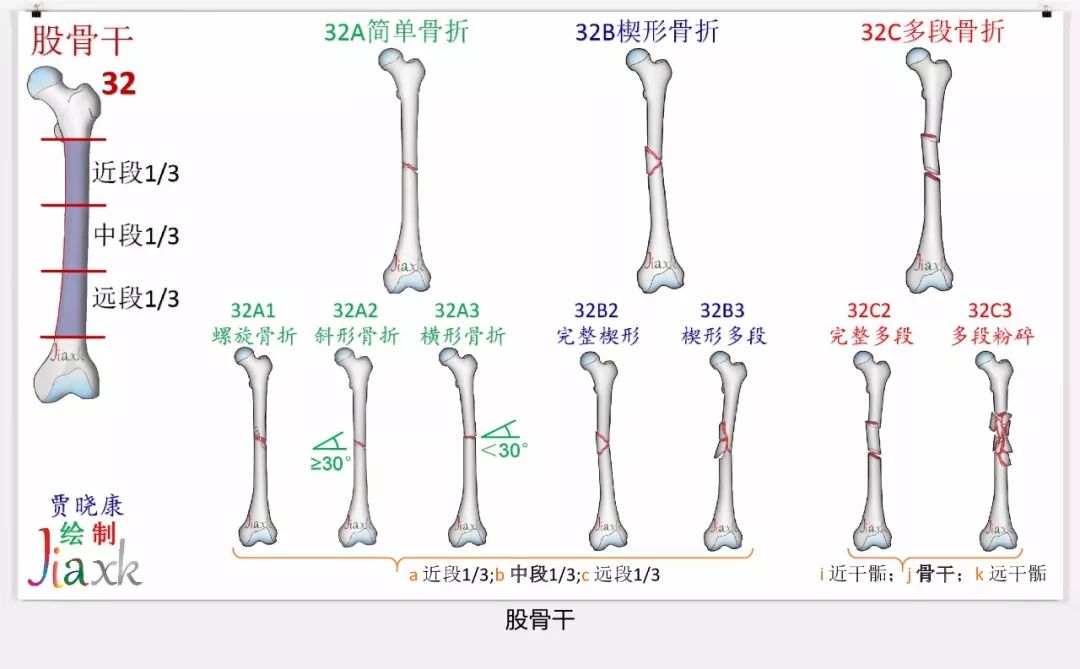 值得收藏！最全的AO骨折分型图谱