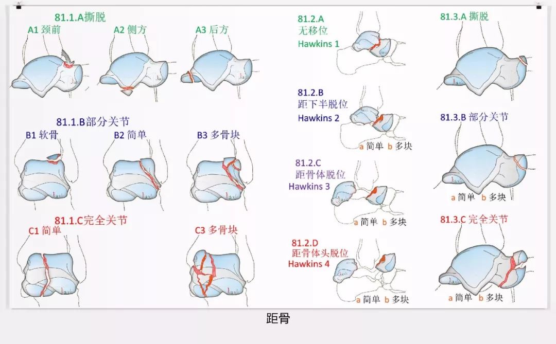 值得收藏！最全的AO骨折分型图谱