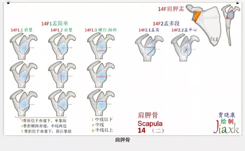 值得收藏！最全的AO骨折分型图谱