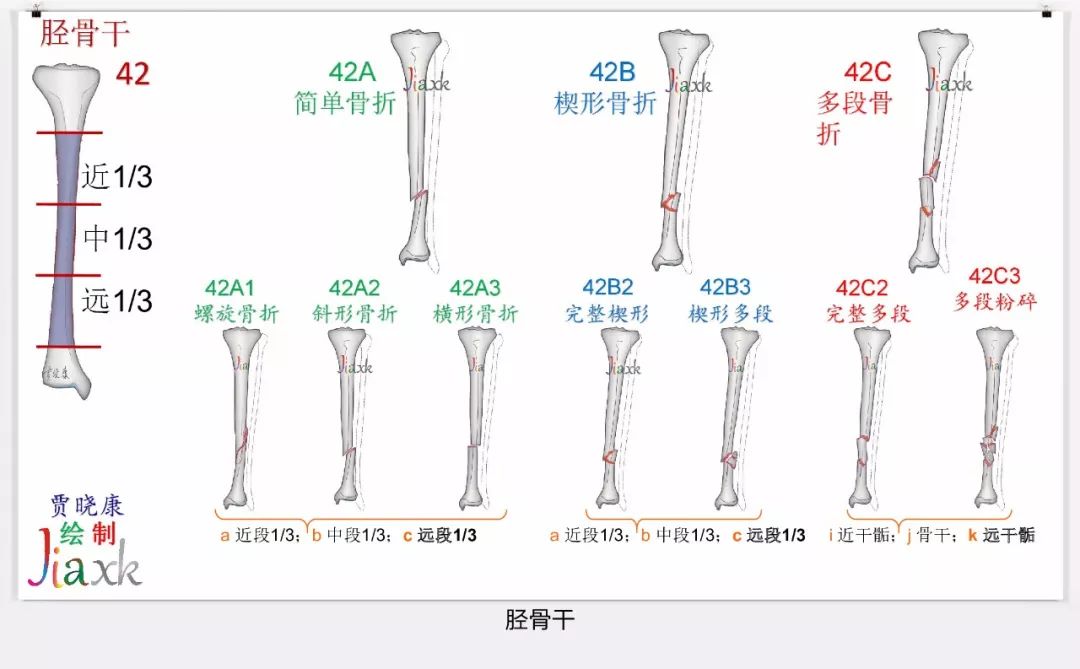 值得收藏！最全的AO骨折分型图谱