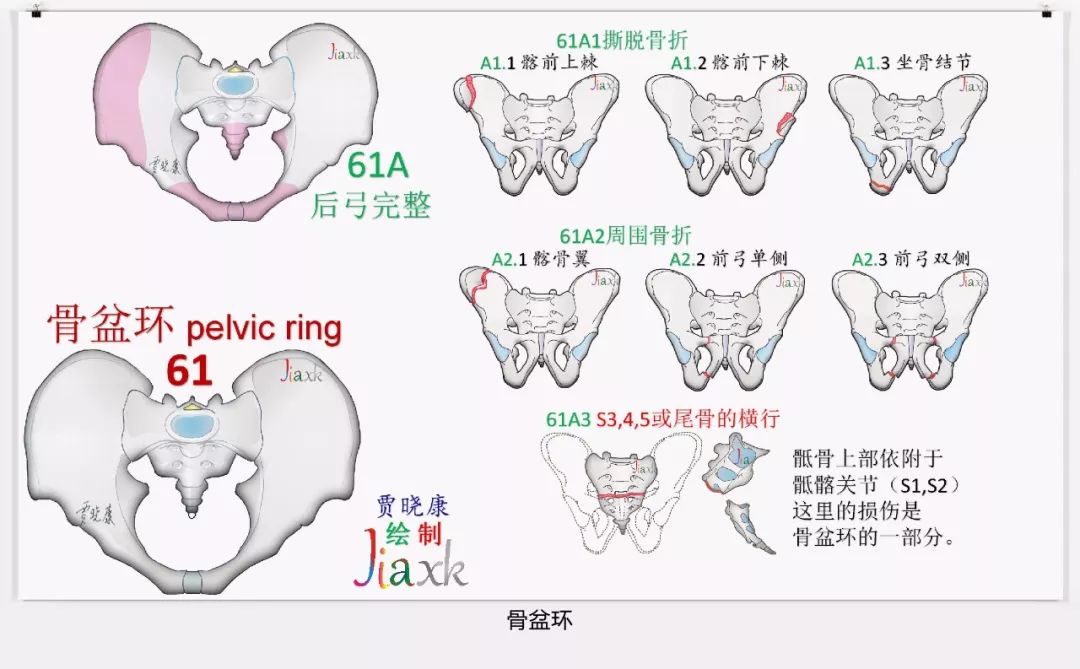 值得收藏！最全的AO骨折分型图谱