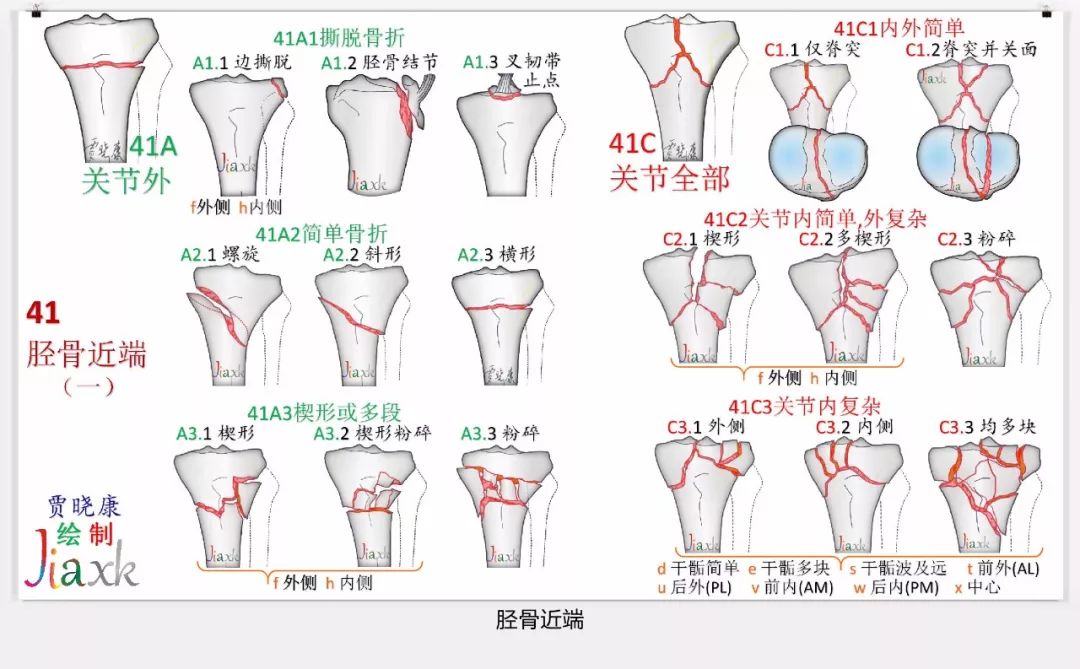 值得收藏！最全的AO骨折分型图谱