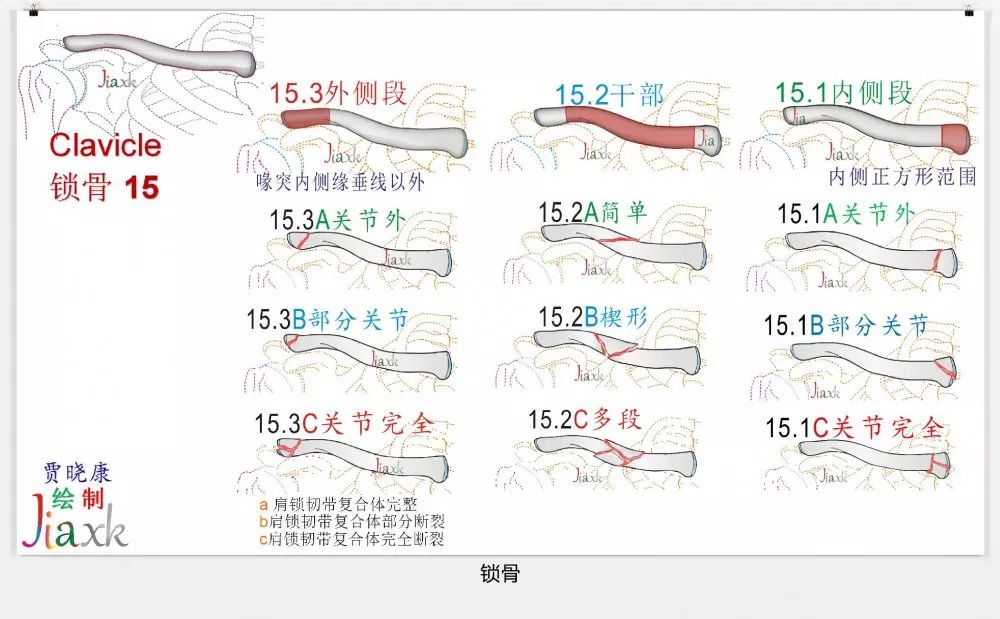 值得收藏！最全的AO骨折分型图谱