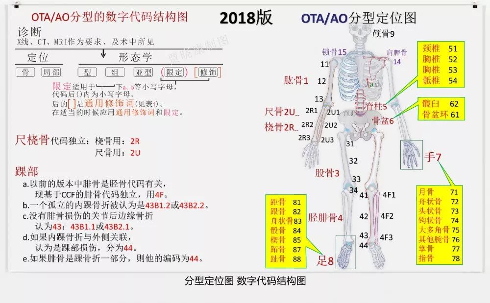 值得收藏！最全的AO骨折分型图谱