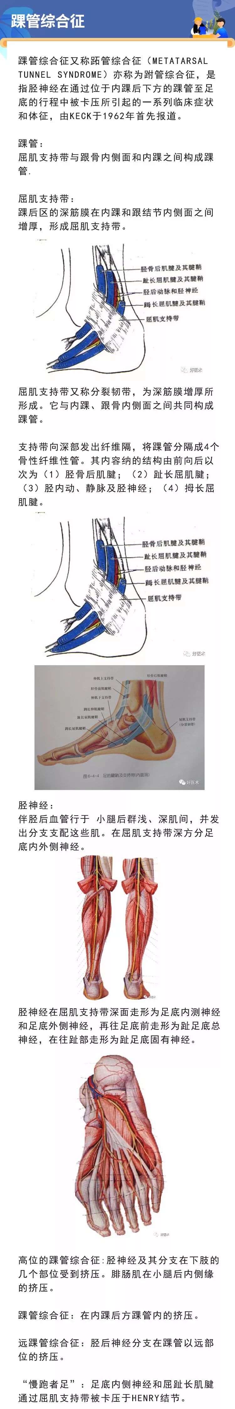 骨科常见周围神经卡压综合征，你都认识吗？