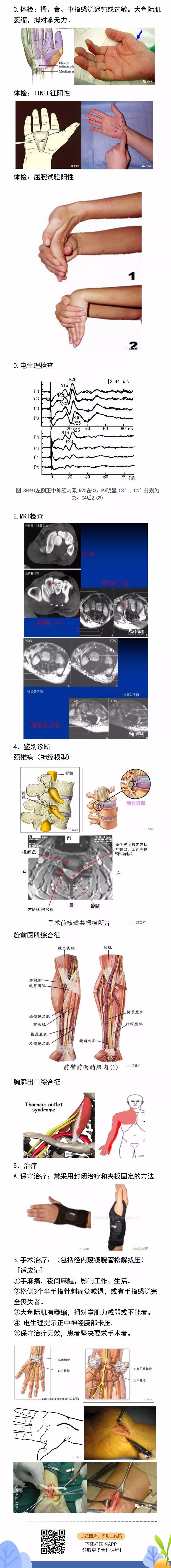 骨科常见周围神经卡压综合征，你都认识吗？