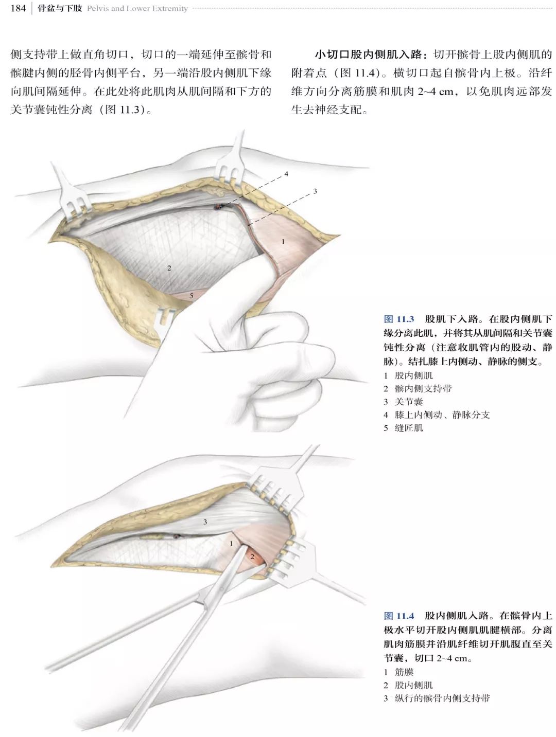 新书推荐：经典骨科手术入路方式，都在这本书里了！