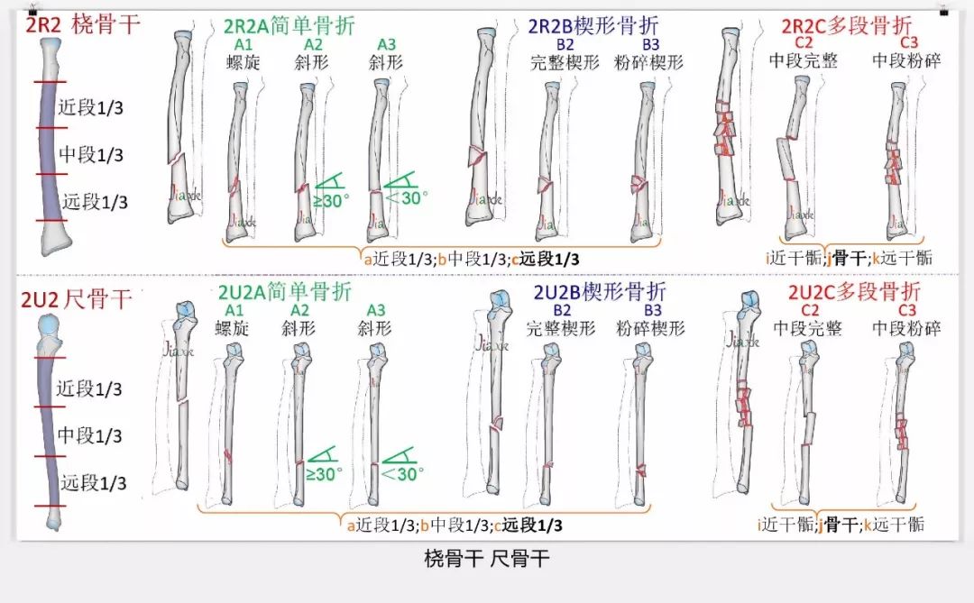 值得收藏！最全的AO骨折分型图谱