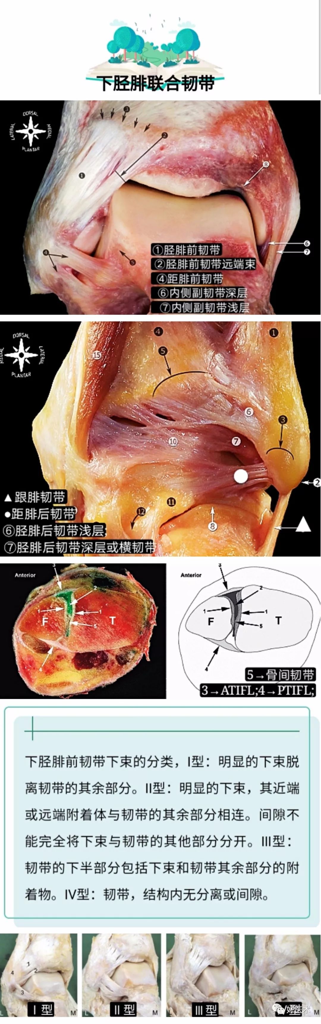 一文搞定！踝关节周围韧带的解剖及MRI特征