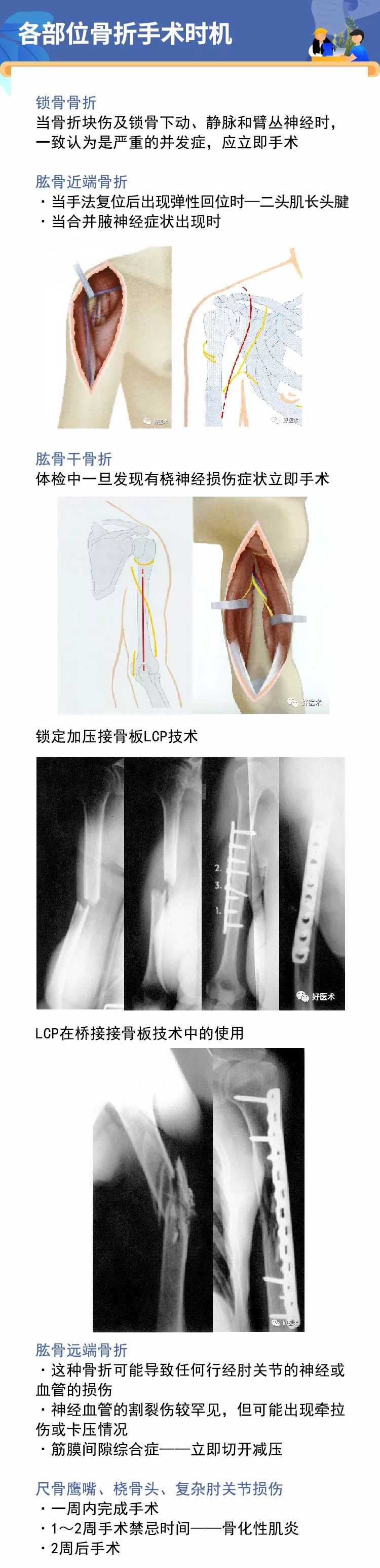 值得收藏！各部位骨折手术时机的选择