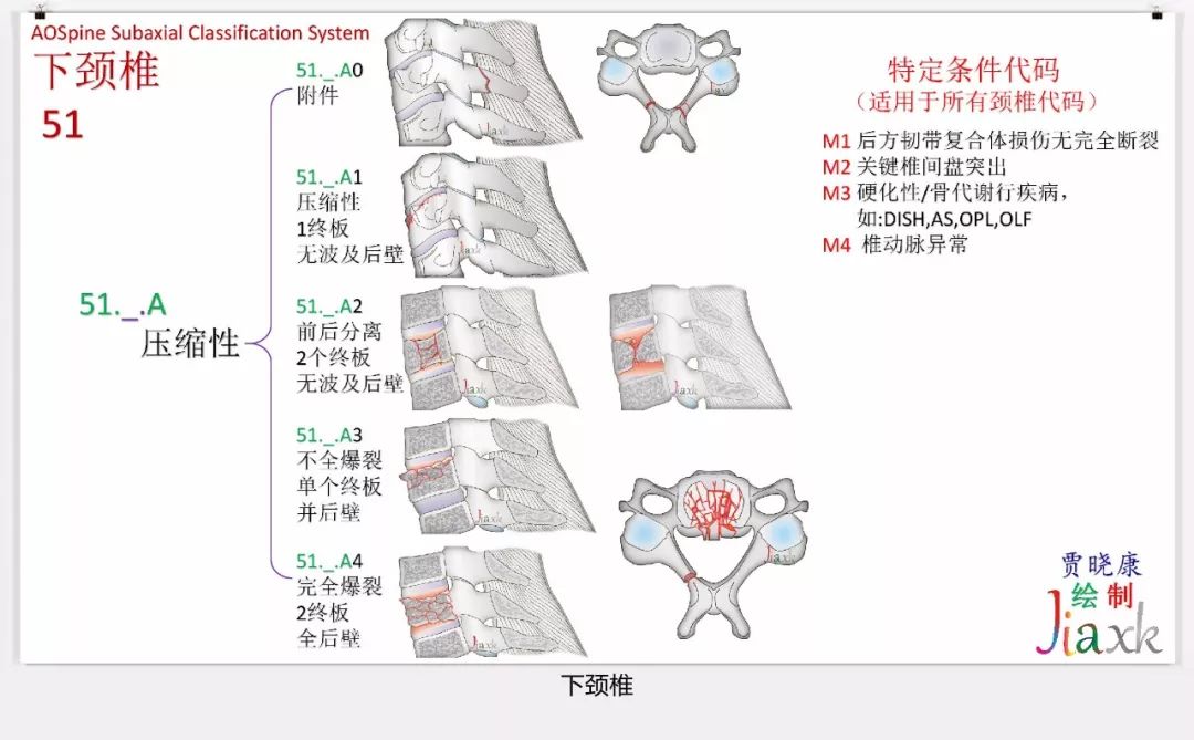 值得收藏！最全的AO骨折分型图谱