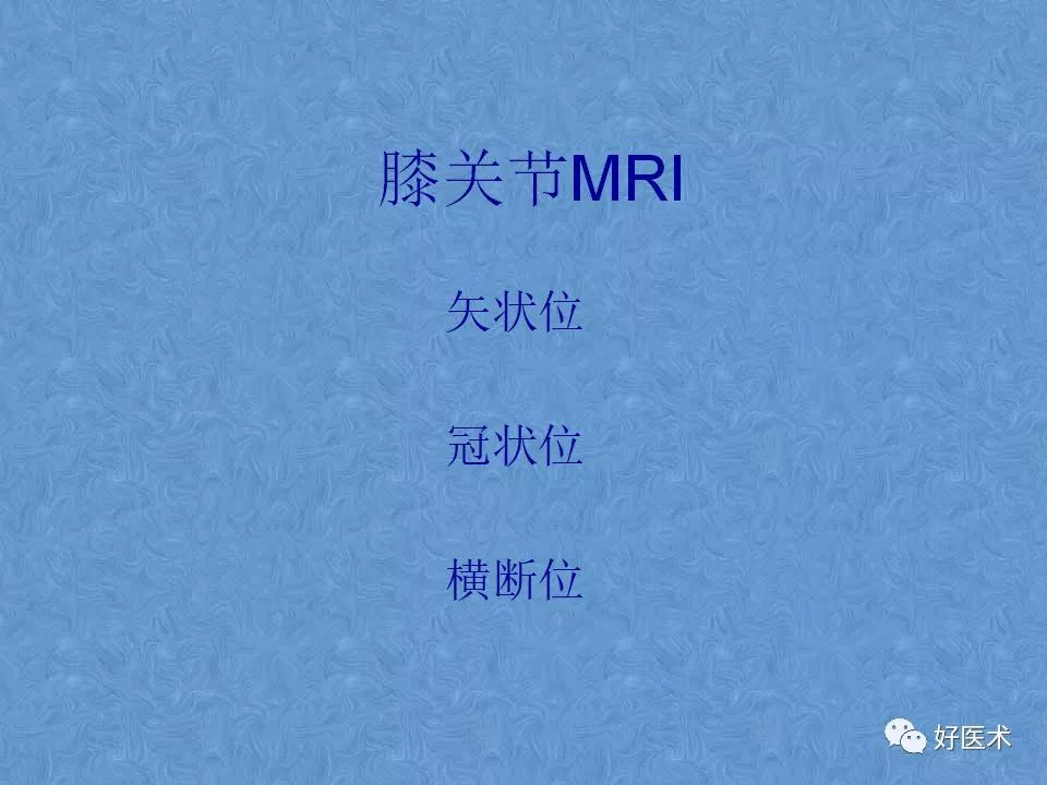 膝关节MRI高清解剖图解，值得收藏！