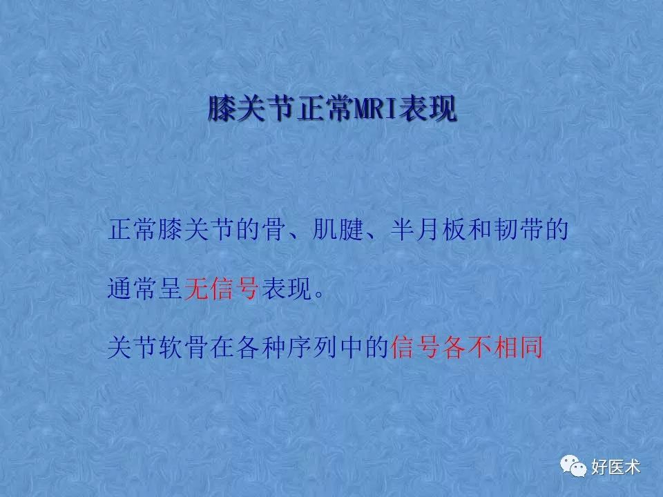 膝关节MRI高清解剖图解，值得收藏！