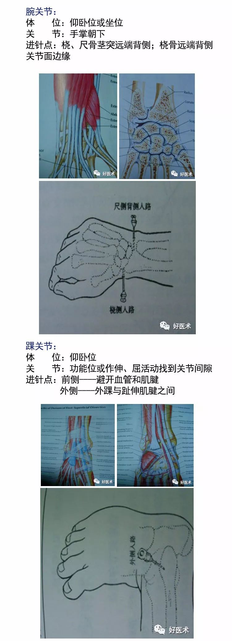 各关节腔穿刺技巧大全，都在这里了！