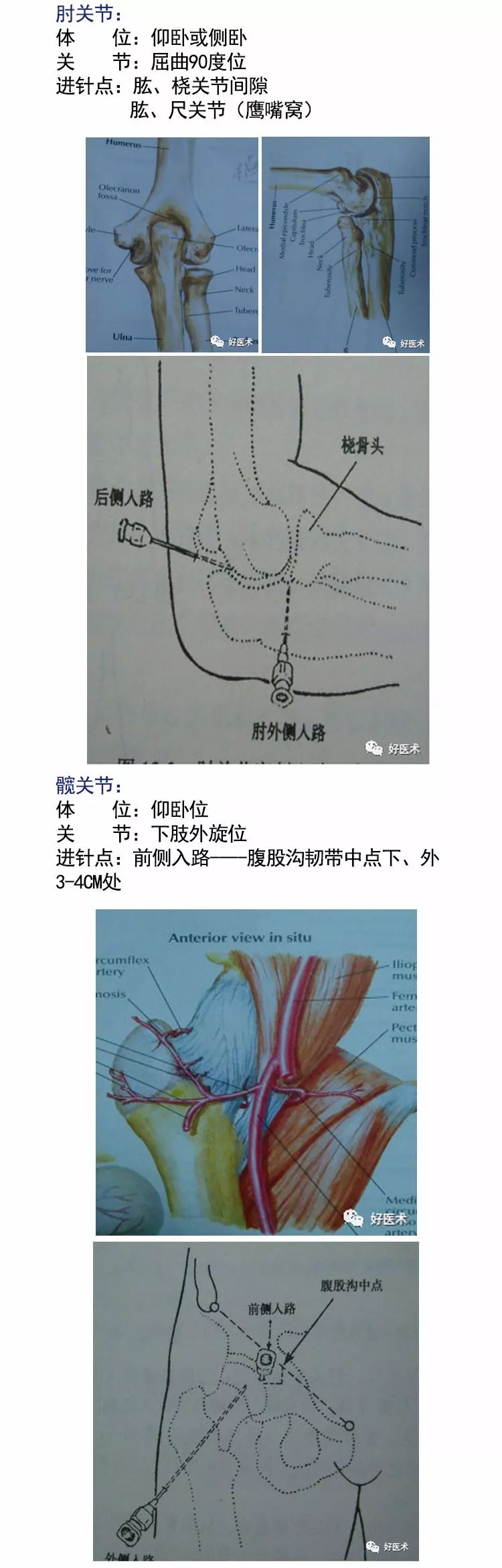 各关节腔穿刺技巧大全，都在这里了！